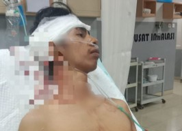 Peristiwa Penebasan Komang MB di Denpasar, ini Kronologinya