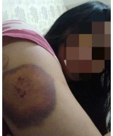 KDRT Terhadap Istri Sirih, Anggota DPRD Sampang Dilaporkan ke Kepolisian