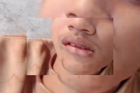 Geger..!! Tiga Remaja Pengamen Jalanan Jadi Korban Bacok Saat Pesta Miras