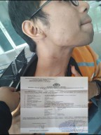 Debt Collector di Laporkan Ke Polrestabes Surabaya, Tagih Hutang dengan Pengeroyokan dan Penganiayaan