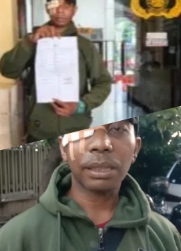 Preman SPA 129 di Jalan Tidar Keroyok Pelanggan yang Tidak Mau Tambah Jam Untuk Pijat Plus