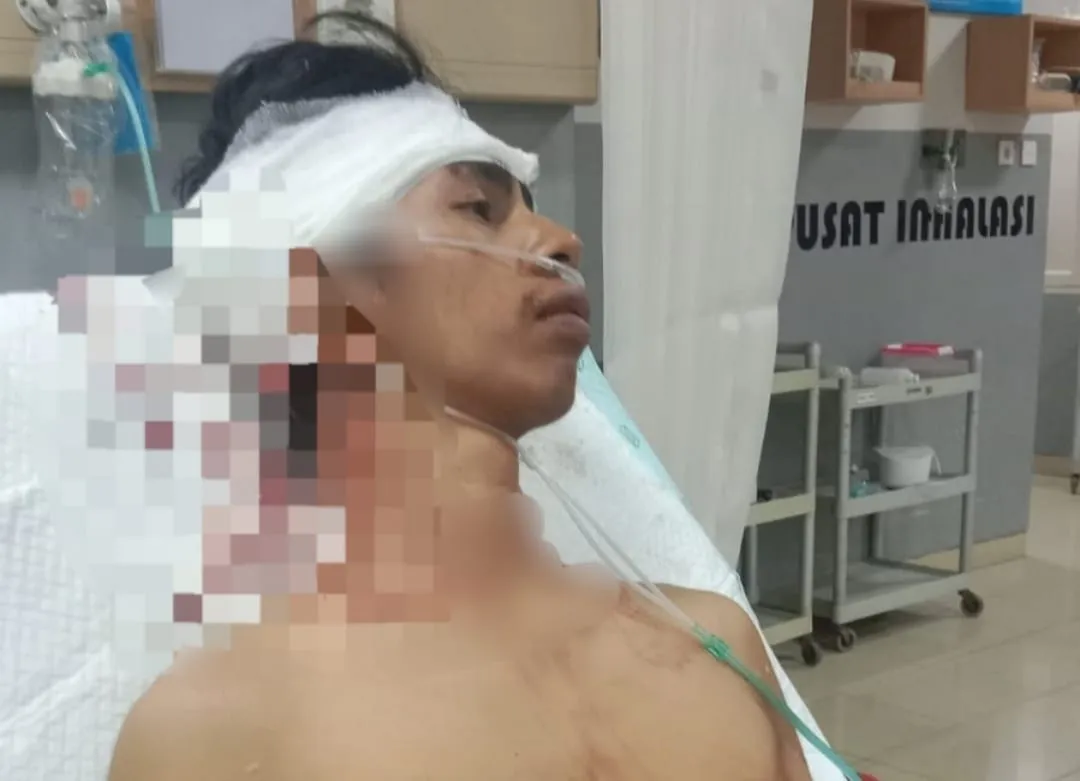 Peristiwa Penebasan Komang MB di Denpasar, ini Kronologinya