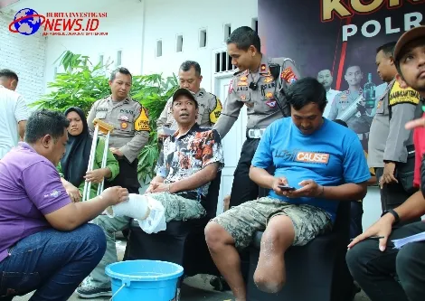 Sambut Hari Bhayangkara Ke-78, Polresta Malang Kota Beri Kaki Palsu Untuk Puluhan Disabilitas