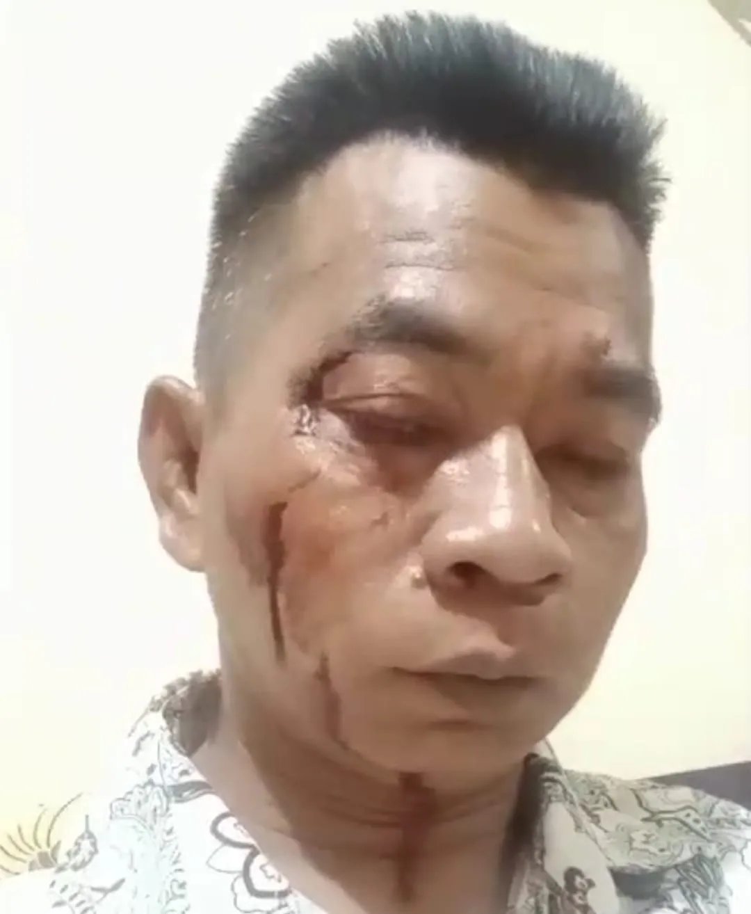 Rekayasa Kasus Pengeroyokan Wartawan, Polres Sumenep Diduga Setting Terlapor Buat Laporan Balik