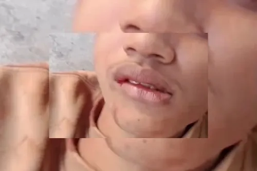 Geger..!! Tiga Remaja Pengamen Jalanan Jadi Korban Bacok Saat Pesta Miras