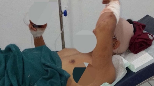 Pembacokan Wartawan di Tuban Harus di Usut Tuntas. APH Segera Tangkap Oknum Preman