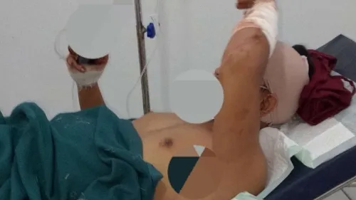 Pembacokan Wartawan di Tuban Harus di Usut Tuntas. APH Segera Tangkap Oknum Preman