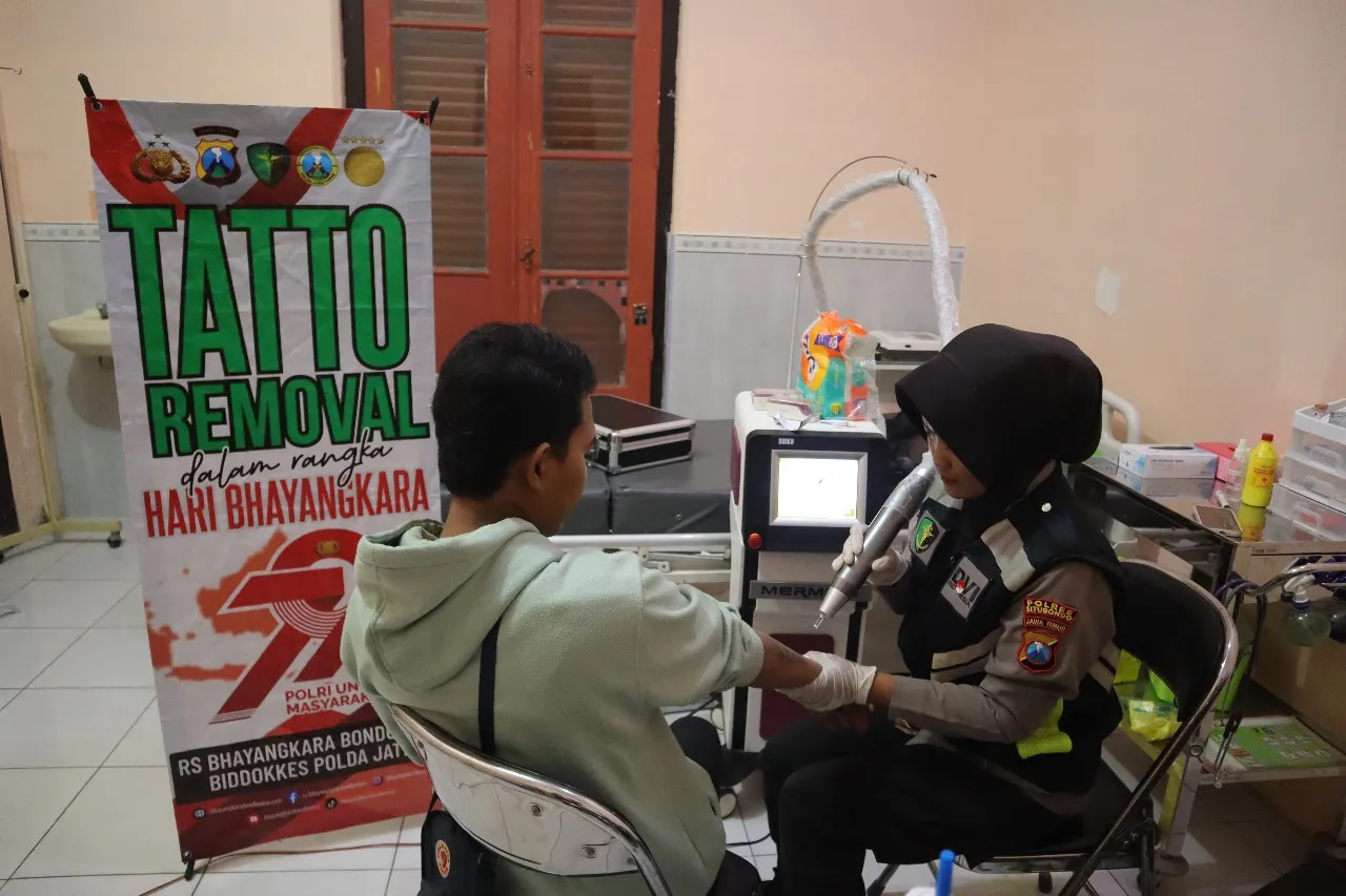 Polres Situbondo Beri Layanan Hapus Tato Gratis di Hari Bhayangkara ke -79